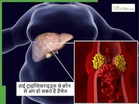 सिर्फ हार्ट ही नहीं शरीर के इन जरूरी अंगों को भी डैमेज कर सकता है High Triglycerides, जानें कैसे होगा कंट्रोल सिर्फ हार्ट ही नहीं शरीर के इन जरूरी अंगों को भी डैमेज कर सकता है High Triglycerides, जानें कैसे होगा कंट्रोल