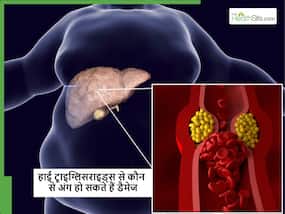 सिर्फ हार्ट ही नहीं शरीर के इन जरूरी अंगों को भी डैमेज कर सकता है High Triglycerides, जानें कैसे होगा कंट्रोल