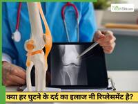 क्या घुटनों के दर्द का Knee Replacement ही आखिरी रास्ता है? डॉक्टर से जानें ऑस्टियोआर्थराइटिस के स्टेज 1-2 में क्या करें