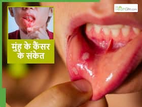 लंबे समय से ठीक नहीं हो रहा मुंह का छाला कहीं Mouth Cancer का संकेत तो नहीं? लंबे समय से ठीक नहीं हो रहा मुंह का छाला कहीं Mouth Cancer का संकेत तो नहीं?