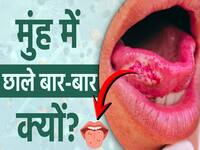 मुंह में छाले बार-बार क्यों होते हैं? जानें कारण और ऐसे में क्या करें
