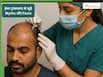 Hair Transplant से जुड़े 9 आम मिथक और उनकी सच्चाई