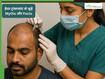 Hair Transplant से जुड़े 9 आम मिथक और उनकी सच्चाई