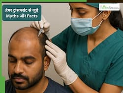 Hair Transplant से जुड़े 9 आम मिथक और उनकी सच्चाई