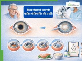 मोतियाबिंद की सर्जरी किस मौसम में करवानी चाहिए?