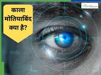 काला मोतियाबिंद क्या है, किन लोगों को काला मोतियाबिंद होने का खतरा ज्यादा है, जानें सब कुछ