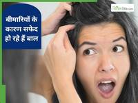 सिर्फ उम्र नहीं, इन 3 बीमारियों की वजह से भी सफेद हो सकते हैं बाल; बता रहे हैं डॉक्टर