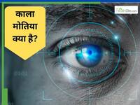 काला मोतिया क्या है, किन लोगों को काला मोतिया होने का खतरा ज्यादा है, जानें सब कुछ