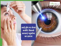 आई ड्रॉप या लेजर सर्जरी, काला मोतिया के इलाज के लिए क्या है बेस्ट
