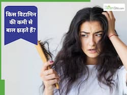 किस विटामिन की कमी से बाल झड़ते हैं?