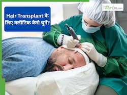हेयर ट्रांसप्लांट करवाने से पहले क्लीनिक कैसे चूज करें, किन बातों का ध्यान रखें