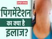 स्किन पिगमेंटेशन क्यों होती है? जानें क्या है इलाज और बचाव का तरीका