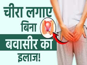 बवासीर का इलाज होगा बिना चीरा लगाए, जानें कैसे?