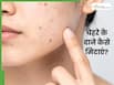 चेहरे पर छोटे-छोटे लाल दाने हो जाए तो क्या करें? जानें 4 उपाय