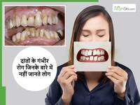 दांतों में दिखे वाले ये 5 संकेत हो सकते हैं बड़ी बीमारी का संकेत, दिखते ही करें डेंटिस्ट से संपर्क
