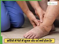 सर्दियों में पैरों में सूजन और दर्द क्यों बढ़ जाते हैं? डॉक्टर ने बताए 5 कारण और उपाय