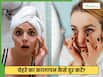चेहरे और आंखों के नीचे का कालापन कैसे दूर करें? जानें 4 तरीके दो दूर करेंगे समस्या
