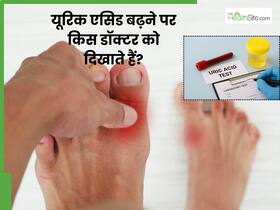 यूरिक एसिड बढ़ने पर कौन से डॉक्टर को दिखाना चाहिए? जानें इस बीमारी के इलाज का प्रोसेस