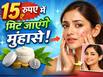 15 रुपए में मिट जाएंगे चेहरे के सारे मुंहासे, बस इस तरह से अप्लाई करें यह सस्ता घरेलू उपाय