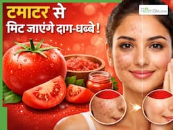 10 रुपए में मिटाने हैं डार्क स्पॉट्स? ये उपाय होगा बेहद असरदार