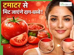 10 रुपए में मिटाने हैं डार्क स्पॉट्स? ये उपाय होगा बेहद असरदार