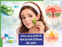 एलोवेरा लगाने से खत्म हो जाते हैं एक्ने और पिंपल्स? AIIMs के डॉक्टर ने बताई इस सोशल मीडिया हाइप की सच्चाई
