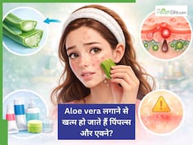 एलोवेरा लगाने से खत्म हो जाते हैं एक्ने और पिंपल्स? AIIMs के डॉक्टर ने बताई इस सोशल मीडिया हाइप की सच्चाई