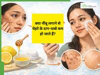 नींबू लगाने से चेहरे के दाग-धब्बे कम हो जाते हैं? ट्राई करने से पहले जान लें इस नुस्खे का कड़वा सच!