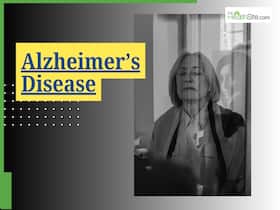 Alzheimer   s Disease: Scientists Connect Memory Problems To Impaired Brain Replay Activity
