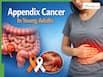 Appendix Cancer Is Rising In Young Adults: Causes, Symptoms, Types And Treatment Explained