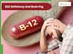 B12 Deficiency And Brain Fog: The Overlooked Cause Of Anxiety And Memory Loss