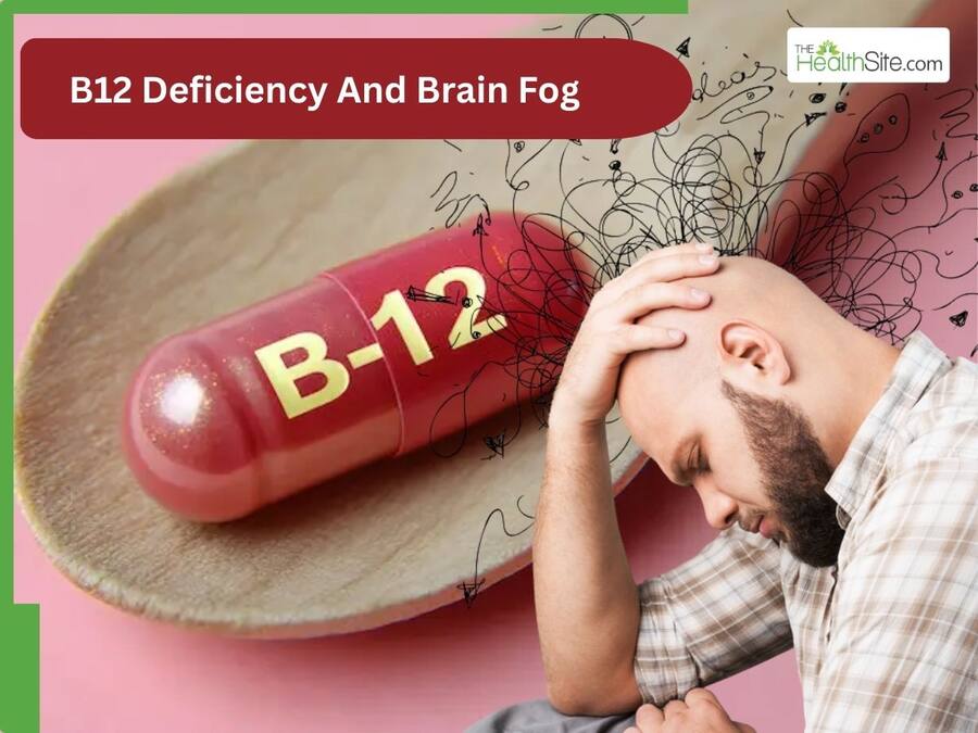 B12 Deficiency And Brain Fog: The Overlooked Cause Of Anxiety And ...
