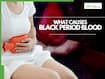 Black Period Blood Sign: 7 Underlying Conditions That Can Turn Menstrual Blood Dark