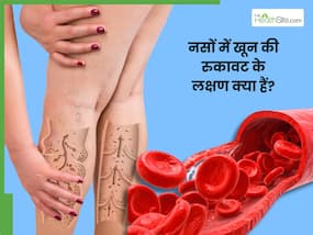 इन लक्षणों से समझ जाएं नसों में हो रही है खून की रुकावट, 1 नंबर के संकेत को कर देते हैं अक्सर इग्नोर