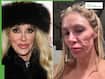 Brandi Glanville Reveals ‘Completely Ruptured’ Breast Implants Behind Facial Parasite Scare