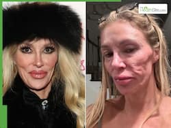 Brandi Glanville Reveals    Completely Ruptured    Breast Implants Behind Facial Parasite Scare