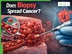 Can a Biopsy Spread Cancer? Doctor Bust The Biggest Myth That Delays Diagnosis