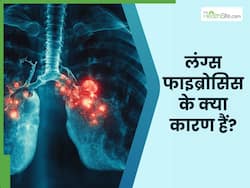 फेफड़ों में फाइब्रोसिस होने का क्या कारण है? डॉक्टर से जानते हैं कैसे होता है इसका इलाज