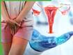 Cervical Cancer Explained: 99% Linked to HPV, Yet Thousands of Women Die Every Year - Oncologist Explains Why It Remains a Silent Killer
