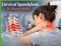 Cervical Spondylosis In Young Adults: How Screen Time And Poor Posture Are Damaging Your Spine