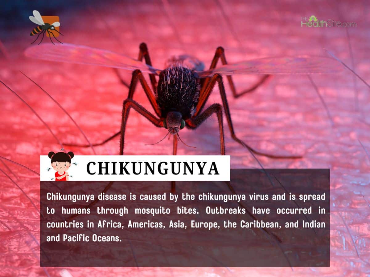 Chikungunya Outbreak 2026