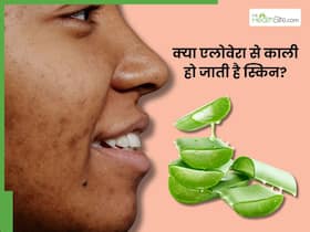 क्या एलोवेरा चेहरे को काला करता है?