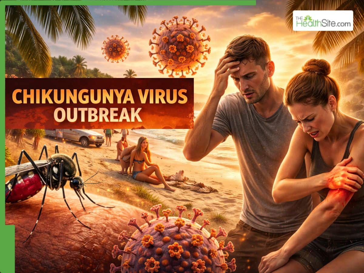 Deadly Chikungunya Virus Outbreak Ravages Seychelles: CDC Warns Travelers of Crippling Joint Pain, Extremely High Fever | Key Points