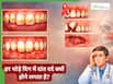 दांतों में पस क्यों जमता है? क्या इलाज में देरी से कैंसर का खतरा बढ़ सकता है