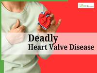 Difficulty In Breathing Could Be A Sign of Aortic Stenosis: All You Need To Know About Deadly Heart Valve Disease