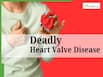 Difficulty In Breathing Could Be A Sign of Aortic Stenosis: All You Need To Know About Deadly Heart Valve Disease