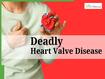 Difficulty In Breathing Could Be A Sign of Aortic Stenosis: All You Need To Know About Deadly Heart Valve Disease