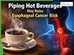 Drinking Very Hot Tea Or Coffee? Cancer Expert Warns Piping Hot Beverages May Raise Esophageal Cancer Risk