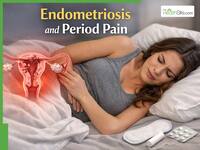 Endometriosis Explained: Why Severe Period Pain Should Never Be Ignored And How Delayed Diagnosis Impacts Fertility