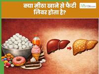 क्या चीनी खाने से फैटी लिवर हो सकता है? डॉक्टर बता रहे हैं घर पर कैसे करें Fatty Liver कंट्रोल